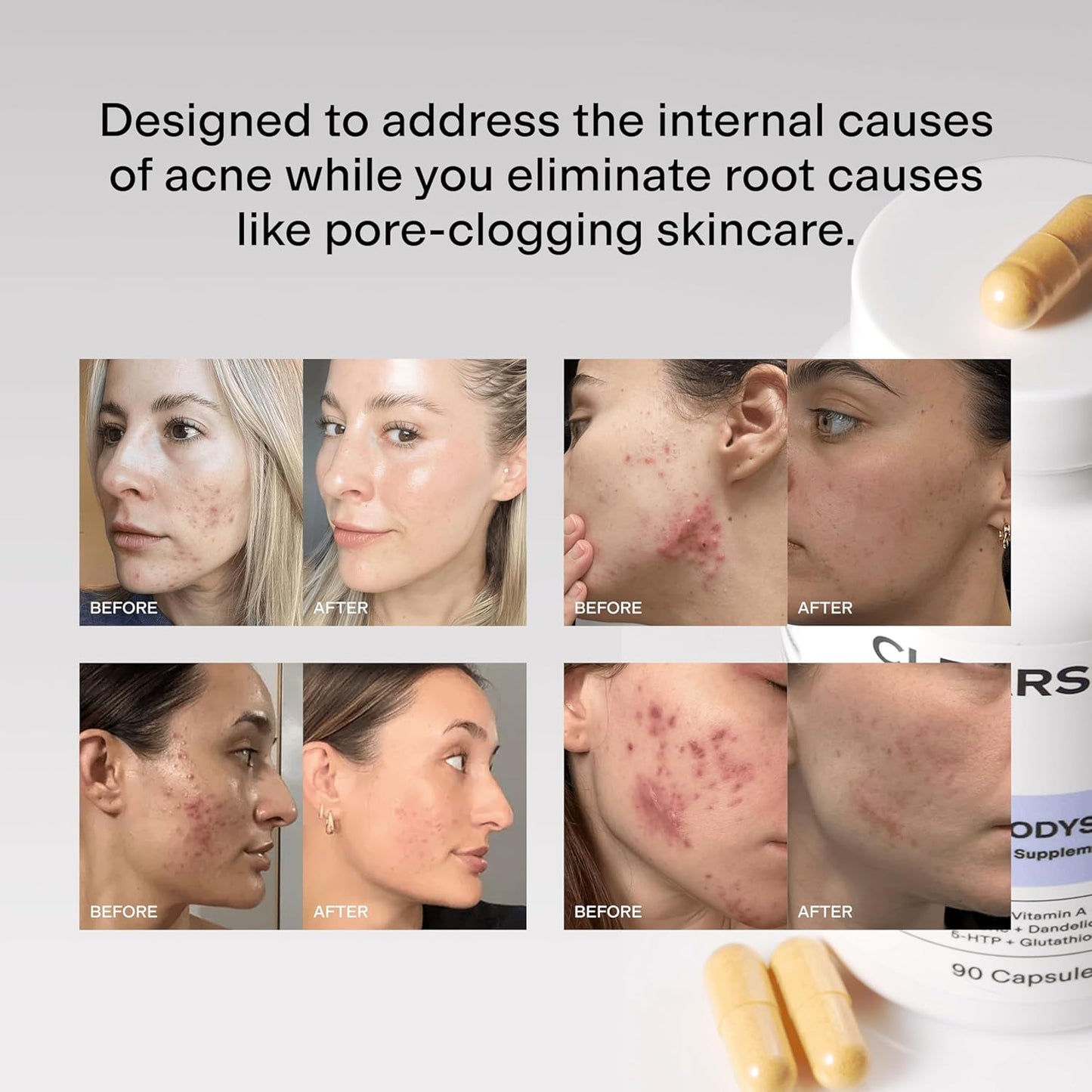 MINDBODYSKIN Hormonal Acne Supplement